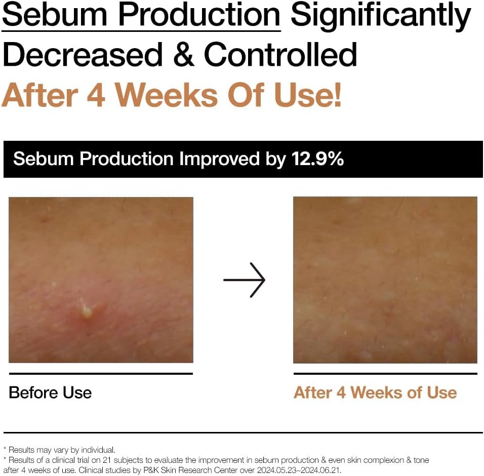 Anua Rice 70 Glow Milky Toner, Glass & Dewy Skin, Hydrating & Barrier Care, Rice Water, Niacinamide, Ceramides, All Skin Types, Fragrance-Free, Non Comedogenic, Korean Skincare, 8.45fl.oz - Image 6