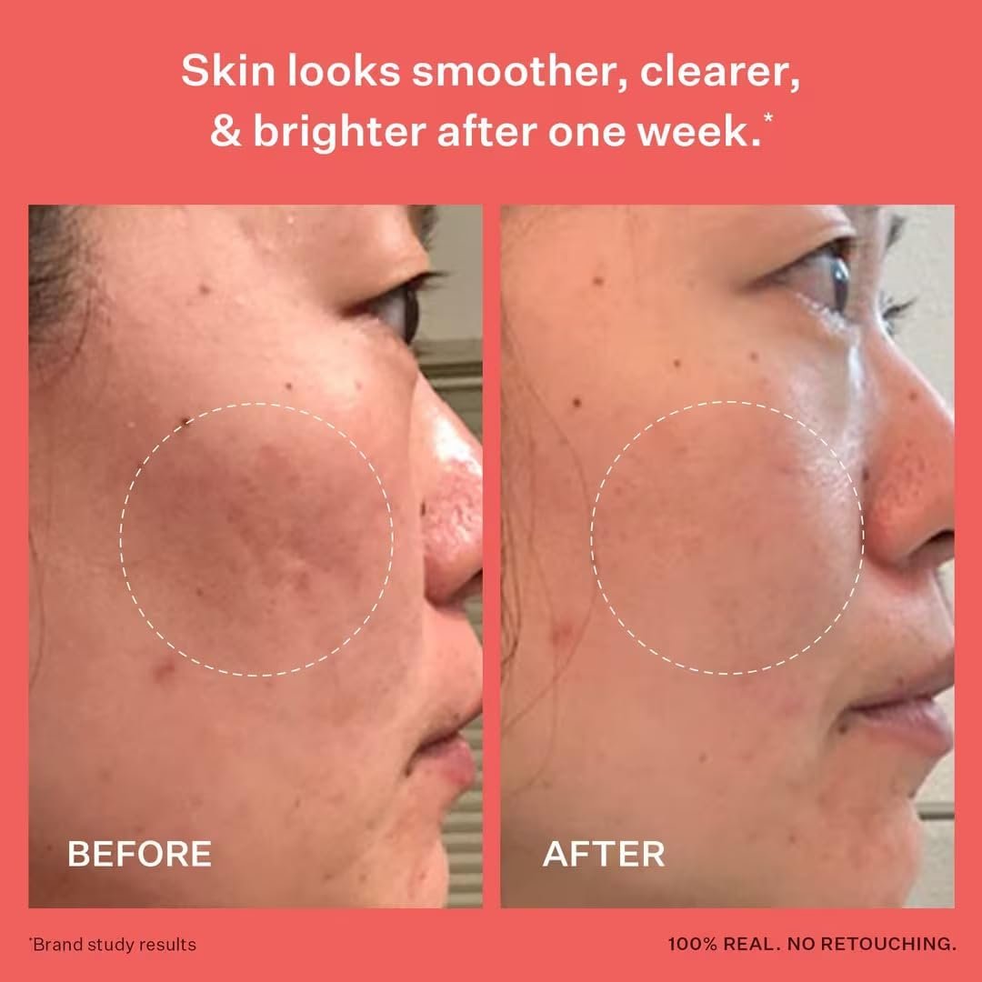 Peach & Lily - Glass Skin Refining Serum for Face (1.35 ounces) - Hyaluronic Acid Niacinamide Serum - Sensitive Skin - Vitamin B3, Peach & Yam, Peptides - Self Care, Vegan, Cruelty Free, Korean Beauty - Image 4